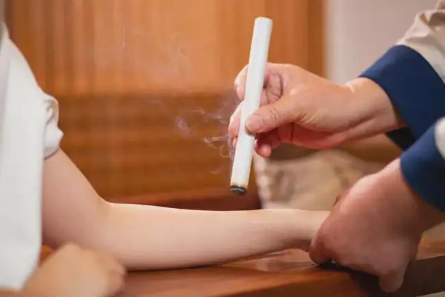 艾灸和拔罐的注意事項,！